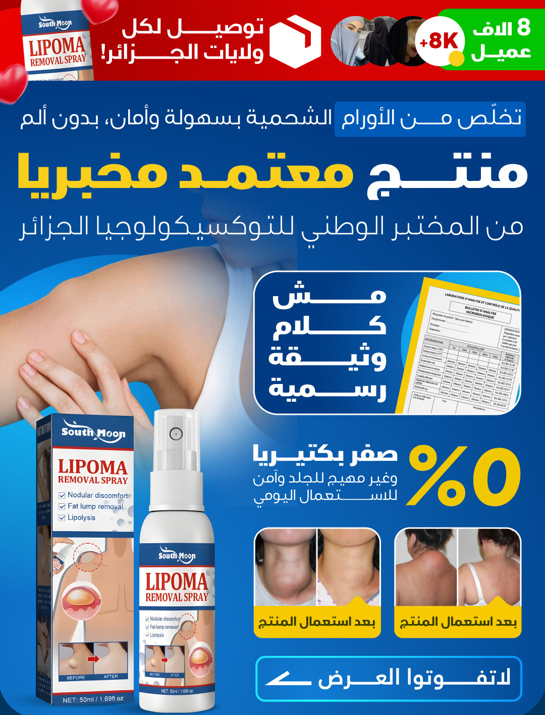 lipoma spray brand